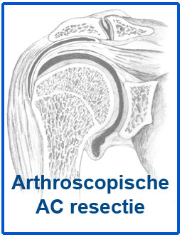 afbeelding fysio protocol